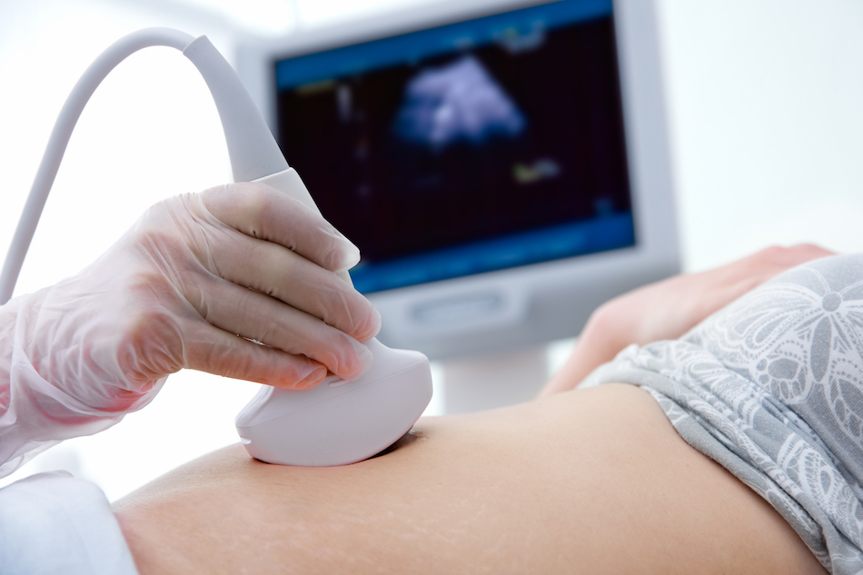 Ultrasound of the ovary